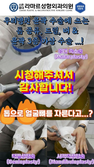 성형수술의 끝판! 성형외과 윤곽수술을 알려드립니다. 저희병원에서 사용하는 수술기구, 그리고 윤곽3종 모의수술....!! 관련 이미지 79
