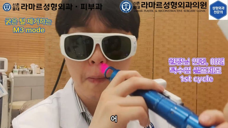 [모영웅 대표원장님 셀프시술 제7편] 인중, 아래턱 제모 시술과정 공개! 관련 이미지 30