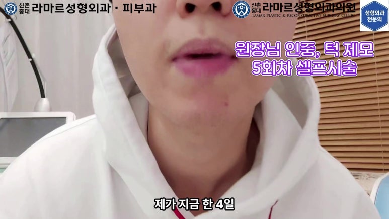 [성형외과 전문의의 셀프시술 제9편] 인중, 아래턱 제모 5,6회차 결과 공개! 관련 이미지 30