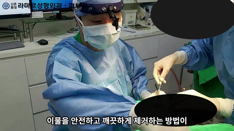파라핀 필러 입 안 절개로 흉터없이 빼내기! 관련 이미지 59