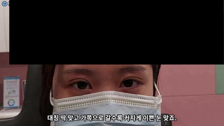매몰 쌍꺼풀 풀고 절개쌍꺼풀로 바꾸는 쌍꺼풀 재수술!! 관련 이미지 74