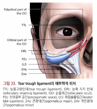 28세 여성, 눈밑지방재배치(눈밑지, 28/F Transconjunctival septal fat redraping-internal fixation technique) 관련 이미지 9