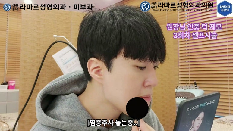 [성형외과 전문의의 셀프시술 제8편] 인중, 아래턱 제모 4회차 결과 공개! 관련 이미지 47