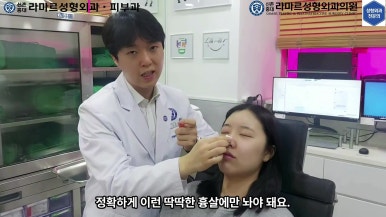 21세 여성 코 지름 1cm 점 제거수술 : 나선피판술(Spiral Flap) 수술전~5달 경과. (+쌍꺼풀수술, 코필러) 관련 이미지 33