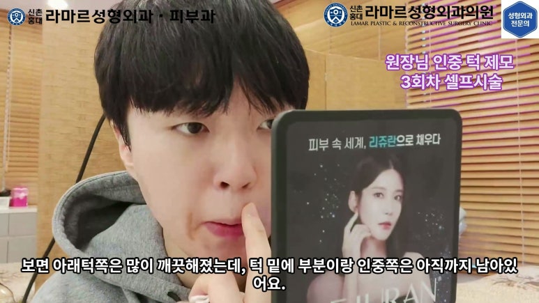 [성형외과 전문의의 셀프시술 제8편] 인중, 아래턱 제모 4회차 결과 공개! 관련 이미지 51