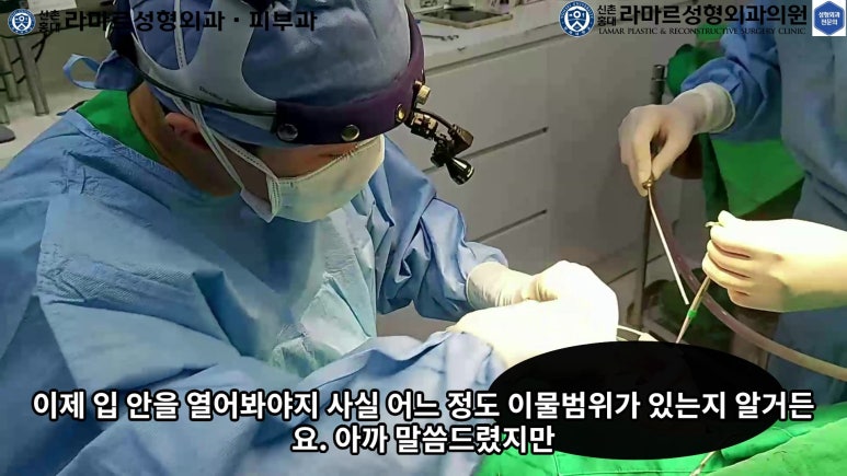 파라핀 필러 입 안 절개로 흉터없이 빼내기! 관련 이미지 28