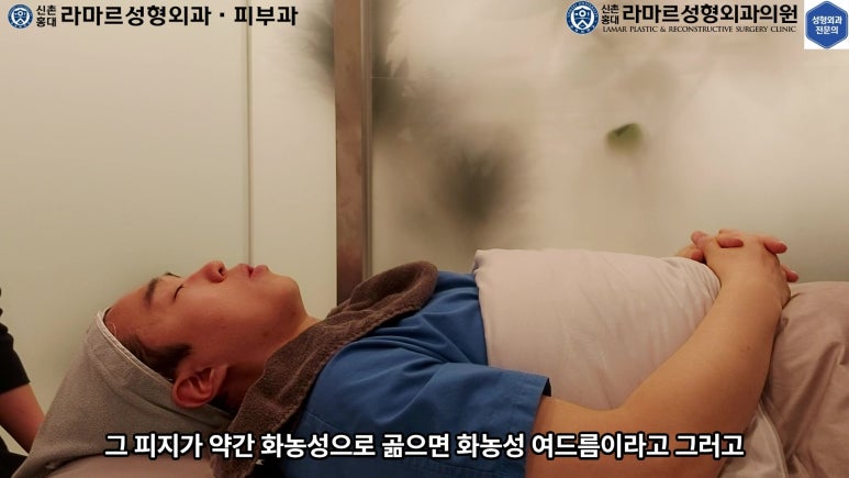 저의 코 모공, 블랙헤드 관리 실제 영상 및 후기~! 관련 이미지 24