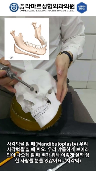 성형수술의 끝판! 성형외과 윤곽수술을 알려드립니다. 저희병원에서 사용하는 수술기구, 그리고 윤곽3종 모의수술....!! 관련 이미지 55