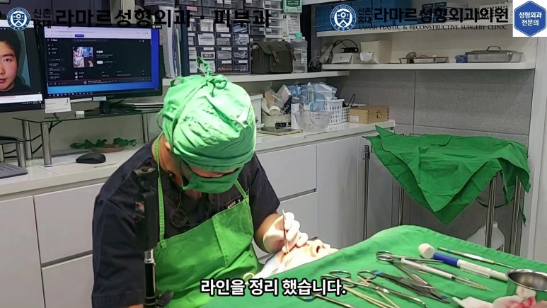 29세 남자, 소시지 쌍꺼풀 두줄따기로 낮추기 (쌍꺼풀 재수술) 관련 이미지 49