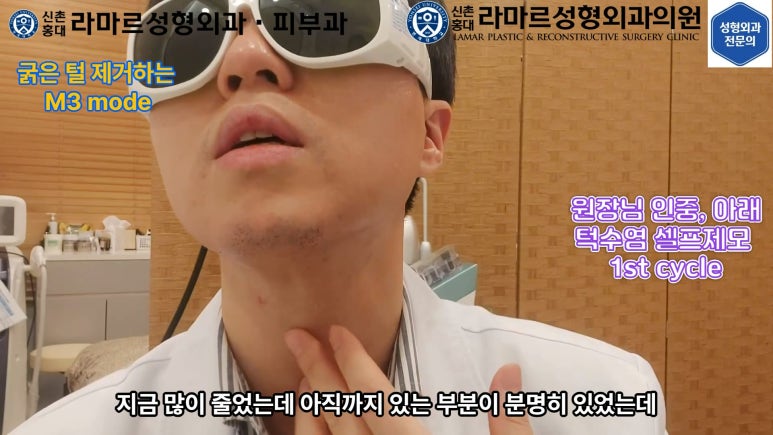 [모영웅 대표원장님 셀프시술 제7편] 인중, 아래턱 제모 시술과정 공개! 관련 이미지 28