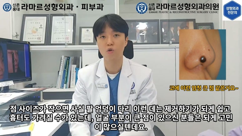 지름 1cm 코 점 제거수술 : 나선피판술(Spiral Flap) 수술전~1달 경과. (Feat. 턱끝필러+사각턱 보톡스) 관련 이미지 18