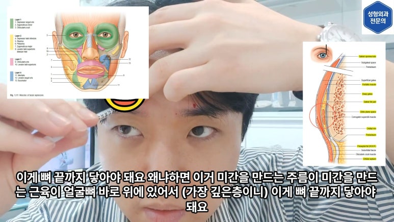 모영웅 대표원장 셀프시술 제6편! 사각턱, 침샘, 미간, 자갈턱 보톡스~! 전체 시술과정 공개합니다 관련 이미지 23