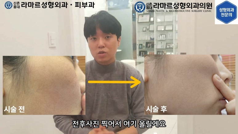 우리병원 토닝레이저 실제 시술과정 보여드립니다. 관련 이미지 36