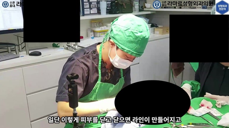 매몰 쌍꺼풀 풀고 절개쌍꺼풀로 바꾸는 쌍꺼풀 재수술!! 관련 이미지 38