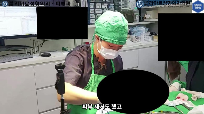 매몰 쌍꺼풀 풀고 절개쌍꺼풀로 바꾸는 쌍꺼풀 재수술!! 관련 이미지 22