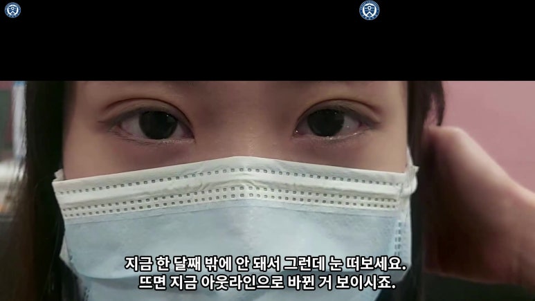 매몰 쌍꺼풀 풀고 절개쌍꺼풀로 바꾸는 쌍꺼풀 재수술!! 관련 이미지 70