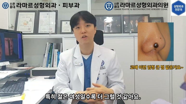 지름 1cm 코 점 제거수술 : 나선피판술(Spiral Flap) 수술전~1달 경과. (Feat. 턱끝필러+사각턱 보톡스) 관련 이미지 19