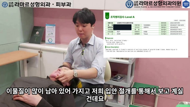 파라핀 필러 입 안 절개로 흉터없이 빼내기! 관련 이미지 94