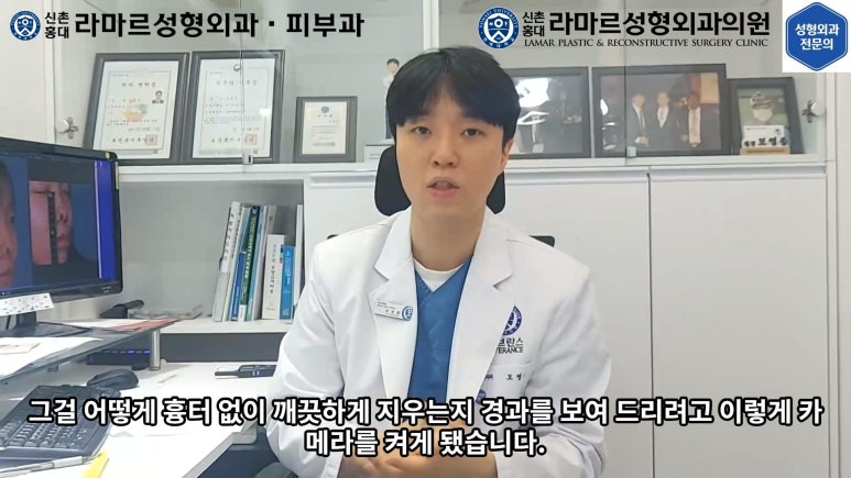 지름 1cm 코 점 제거수술 : 나선피판술(Spiral Flap) 수술전~1달 경과. (Feat. 턱끝필러+사각턱 보톡스) 관련 이미지 24