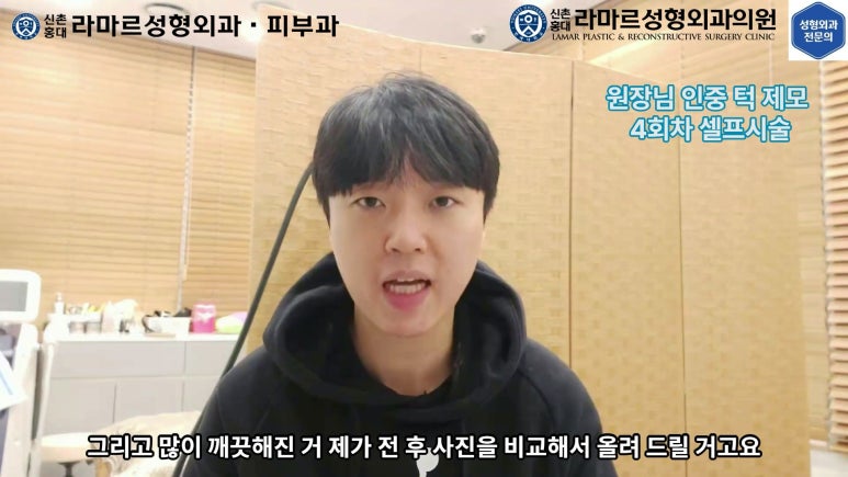 [성형외과 전문의의 셀프시술 제8편] 인중, 아래턱 제모 4회차 결과 공개! 관련 이미지 153