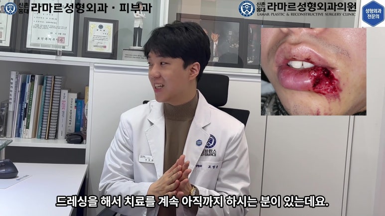 개에 물려 입술 1/3이 뜯긴 19세 남자분 치료 및 흉터 성형수술& 레이저 후기....! 관련 이미지 13