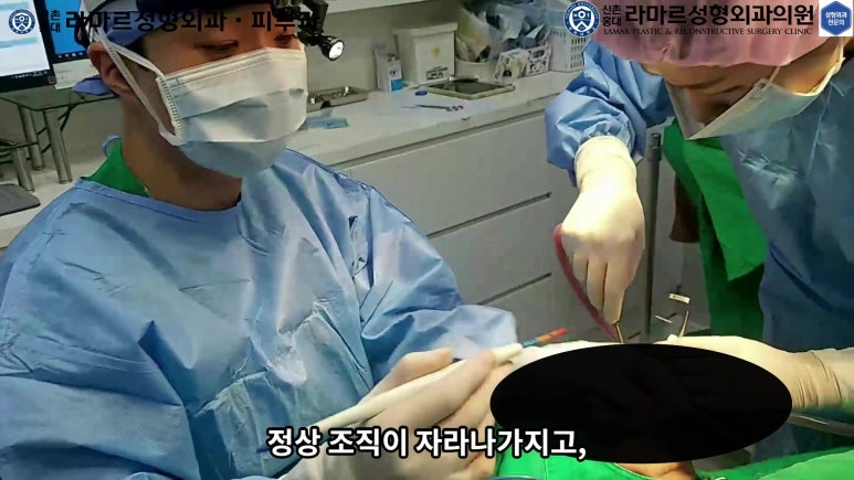 파라핀 필러 입 안 절개로 흉터없이 빼내기! 관련 이미지 32