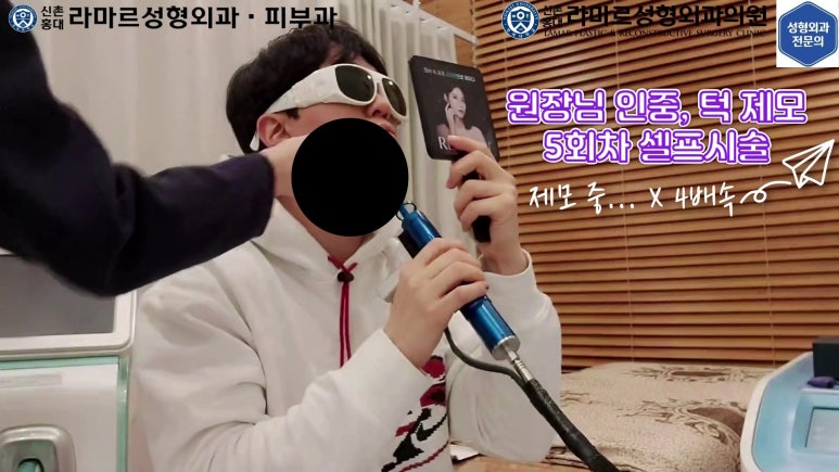 [성형외과 전문의의 셀프시술 제9편] 인중, 아래턱 제모 5,6회차 결과 공개! 관련 이미지 34