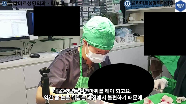 매몰 쌍꺼풀 풀고 절개쌍꺼풀로 바꾸는 쌍꺼풀 재수술!! 관련 이미지 26
