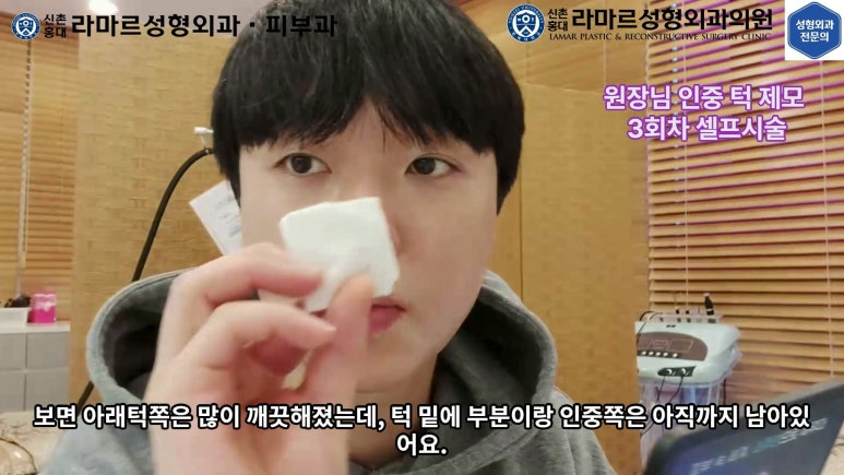 [성형외과 전문의의 셀프시술 제8편] 인중, 아래턱 제모 4회차 결과 공개! 관련 이미지 49
