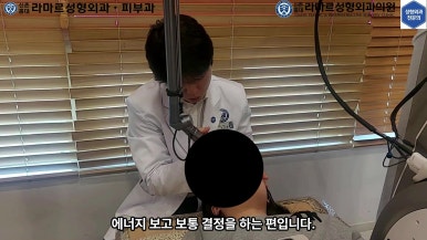 21세 여성 코 지름 1cm 점 제거수술 : 나선피판술(Spiral Flap) 수술전~5달 경과. (+쌍꺼풀수술, 코필러) 관련 이미지 44