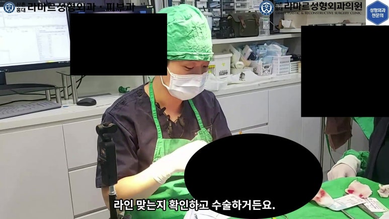 매몰 쌍꺼풀 풀고 절개쌍꺼풀로 바꾸는 쌍꺼풀 재수술!! 관련 이미지 29