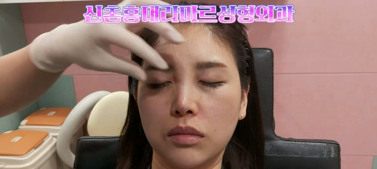 30대 여성 팔자필러 시술: 팔자주름과 안전이별 하는 법 관련 이미지 11