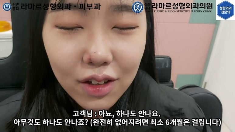지름 1cm 코 점 제거수술 : 나선피판술(Spiral Flap) 수술전~1달 경과. (Feat. 턱끝필러+사각턱 보톡스) 관련 이미지 163