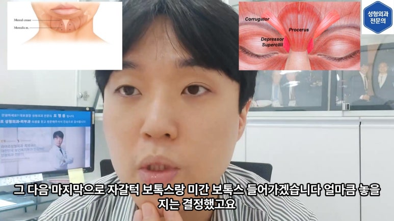 모영웅 대표원장 셀프시술 제6편! 사각턱, 침샘, 미간, 자갈턱 보톡스~! 전체 시술과정 공개합니다 관련 이미지 20