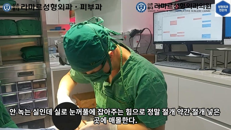 30대 여성 "쌍꺼풀+눈매교정" 상담, 디자인, 수술 전체 과정, 결과, 경과 모두 공개합니다. 관련 이미지 34