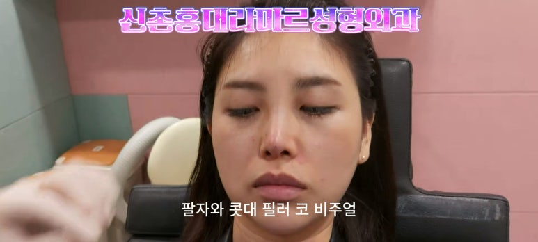 30대 여성 팔자필러 시술: 팔자주름과 안전이별 하는 법 관련 이미지 10