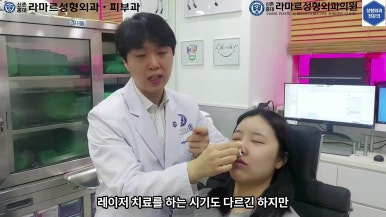 21세 여성 코 지름 1cm 점 제거수술 : 나선피판술(Spiral Flap) 수술전~5달 경과. (+쌍꺼풀수술, 코필러) 관련 이미지 35