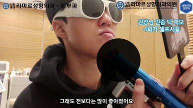 [성형외과 전문의의 셀프시술 제8편] 인중, 아래턱 제모 4회차 결과 공개! 관련 이미지 105