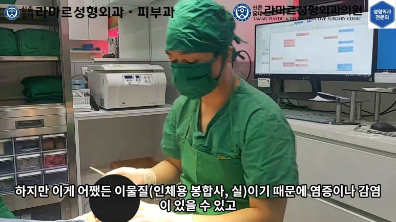 30대 여성 "쌍꺼풀+눈매교정" 상담, 디자인, 수술 전체 과정, 결과, 경과 모두 공개합니다. 관련 이미지 36