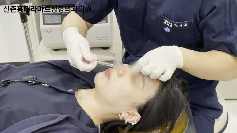 20대 여성 코필러 시술 영상 관련 이미지 6