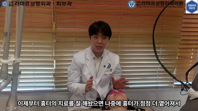 21세 여성 코 지름 1cm 점 제거수술 : 나선피판술(Spiral Flap) 수술전~5달 경과. (+쌍꺼풀수술, 코필러) 관련 이미지 52