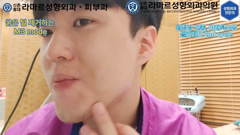 [모영웅 대표원장님 셀프시술 제7편] 인중, 아래턱 제모 시술과정 공개! 관련 이미지 36