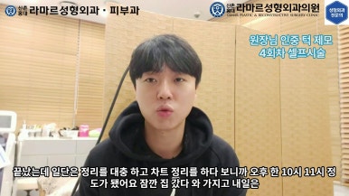 [성형외과 전문의의 셀프시술 제8편] 인중, 아래턱 제모 4회차 결과 공개! 관련 이미지 88