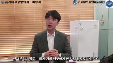 21세 여성 코 지름 1cm 점 제거수술 : 나선피판술(Spiral Flap) 수술전~5달 경과. (+쌍꺼풀수술, 코필러) 관련 이미지 63