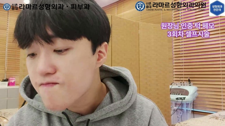 [성형외과 전문의의 셀프시술 제8편] 인중, 아래턱 제모 4회차 결과 공개! 관련 이미지 70