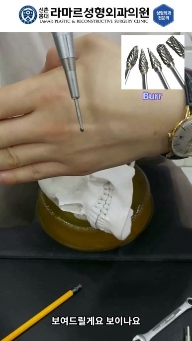 성형수술의 끝판! 성형외과 윤곽수술을 알려드립니다. 저희병원에서 사용하는 수술기구, 그리고 윤곽3종 모의수술....!! 관련 이미지 65