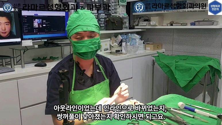 29세 남자, 소시지 쌍꺼풀 두줄따기로 낮추기 (쌍꺼풀 재수술) 관련 이미지 43