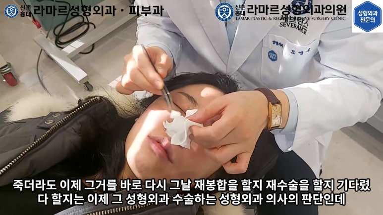 지름 1cm 코 점 제거수술 : 나선피판술(Spiral Flap) 수술전~1달 경과. (Feat. 턱끝필러+사각턱 보톡스) 관련 이미지 68