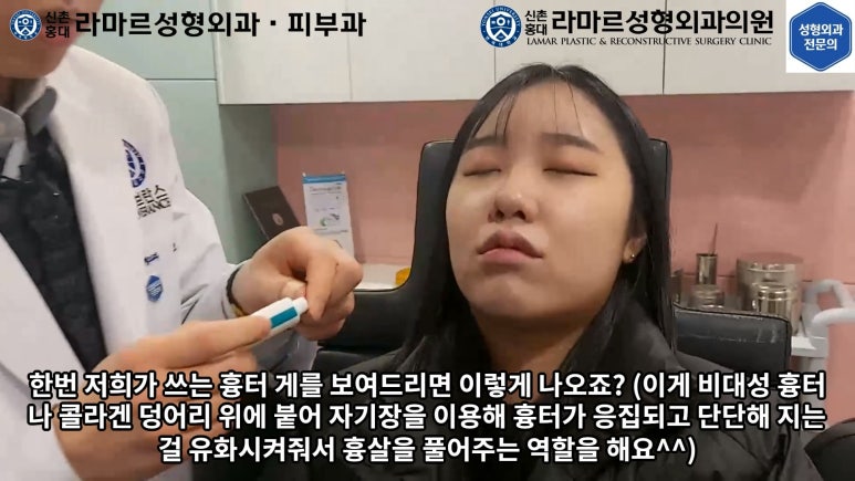 지름 1cm 코 점 제거수술 : 나선피판술(Spiral Flap) 수술전~1달 경과. (Feat. 턱끝필러+사각턱 보톡스) 관련 이미지 174