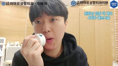 [성형외과 전문의의 셀프시술 제8편] 인중, 아래턱 제모 4회차 결과 공개! 관련 이미지 137